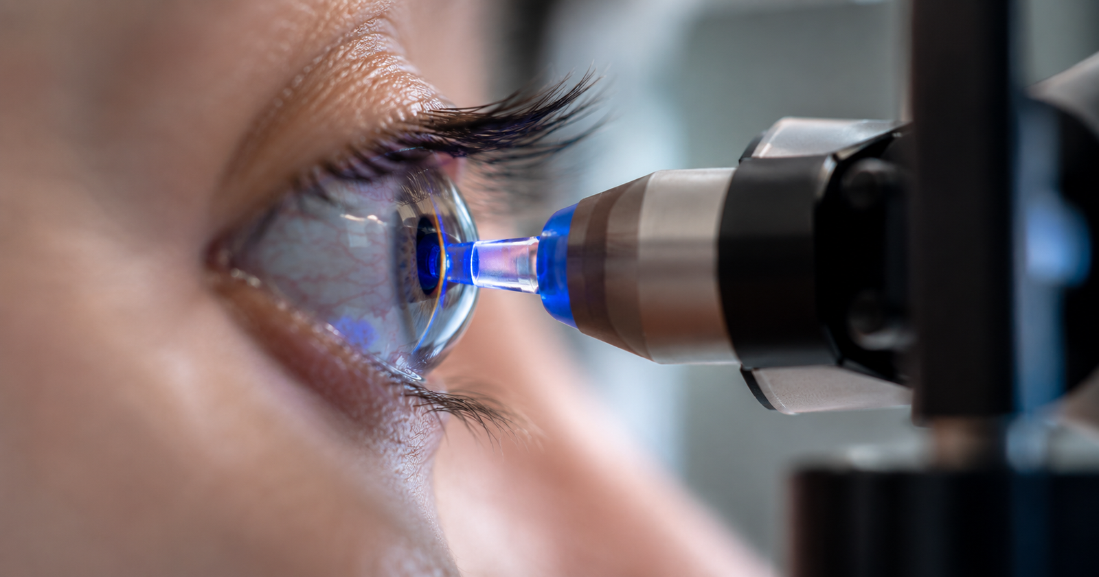 Exame de medida da pressão ocular para diagnóstico de glaucoma em consultório em Formiga MG
